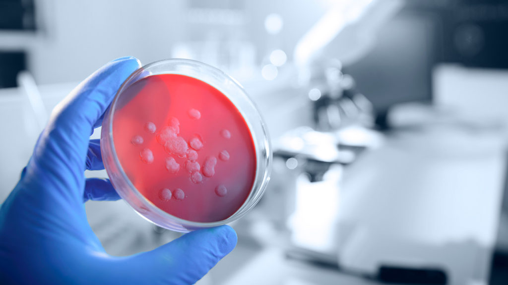 Бактериални срещу вирусни инфекции: Разликите